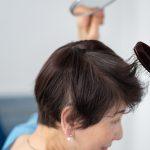 Female Hair Thinning Treatments: What Are Your Options?